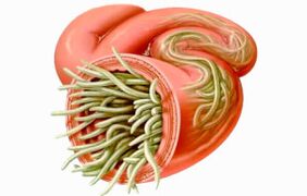 Como limpar o intestino dos parásitos