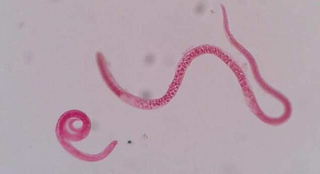 Como son as triquinas