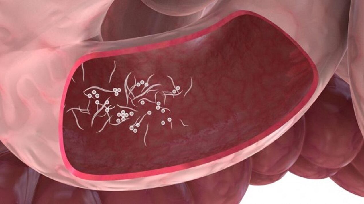 Parasitos de Giardia no fígado