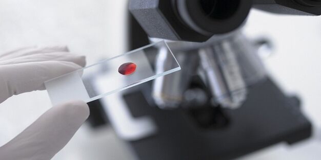 Proba de sangue para diagnosticar parasitos no corpo