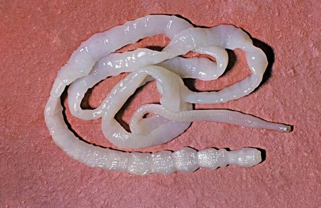 Que aspecto ten unha tenia de touro