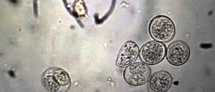 Células protozoarias parasitarias